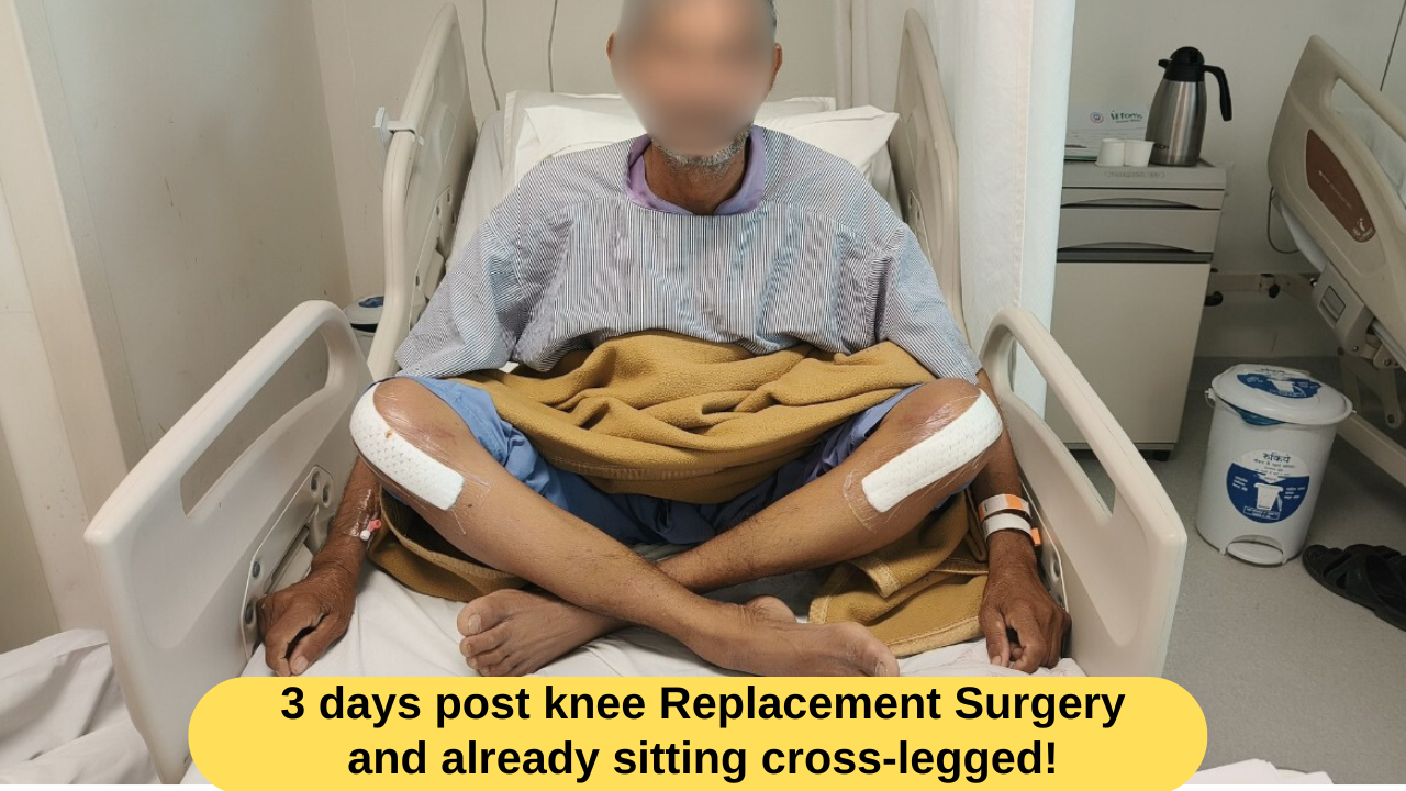 It Represents Knee Replacement Surgery Before After